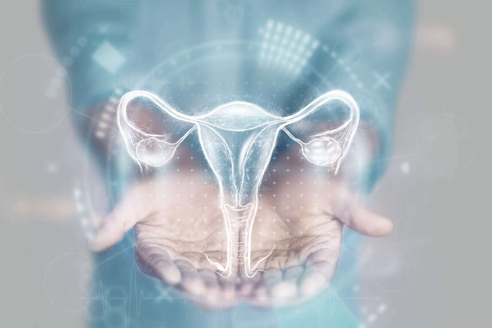 Acupuntura para SOP